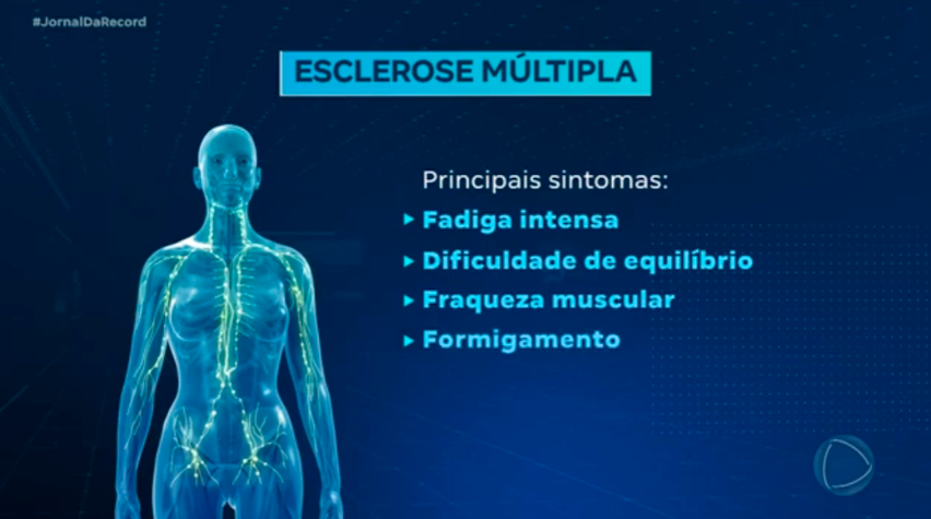 Esclerose múltipla: 2,8 milhões de pessoas já foram diagnosticadas em todo o mundo