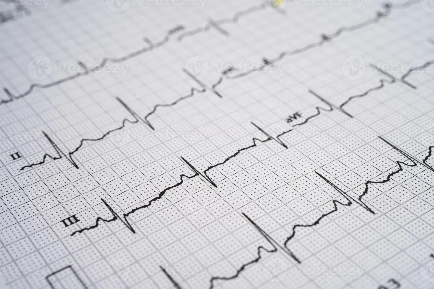 ELETROCARDIOGRAMA - UNIDADES E CC