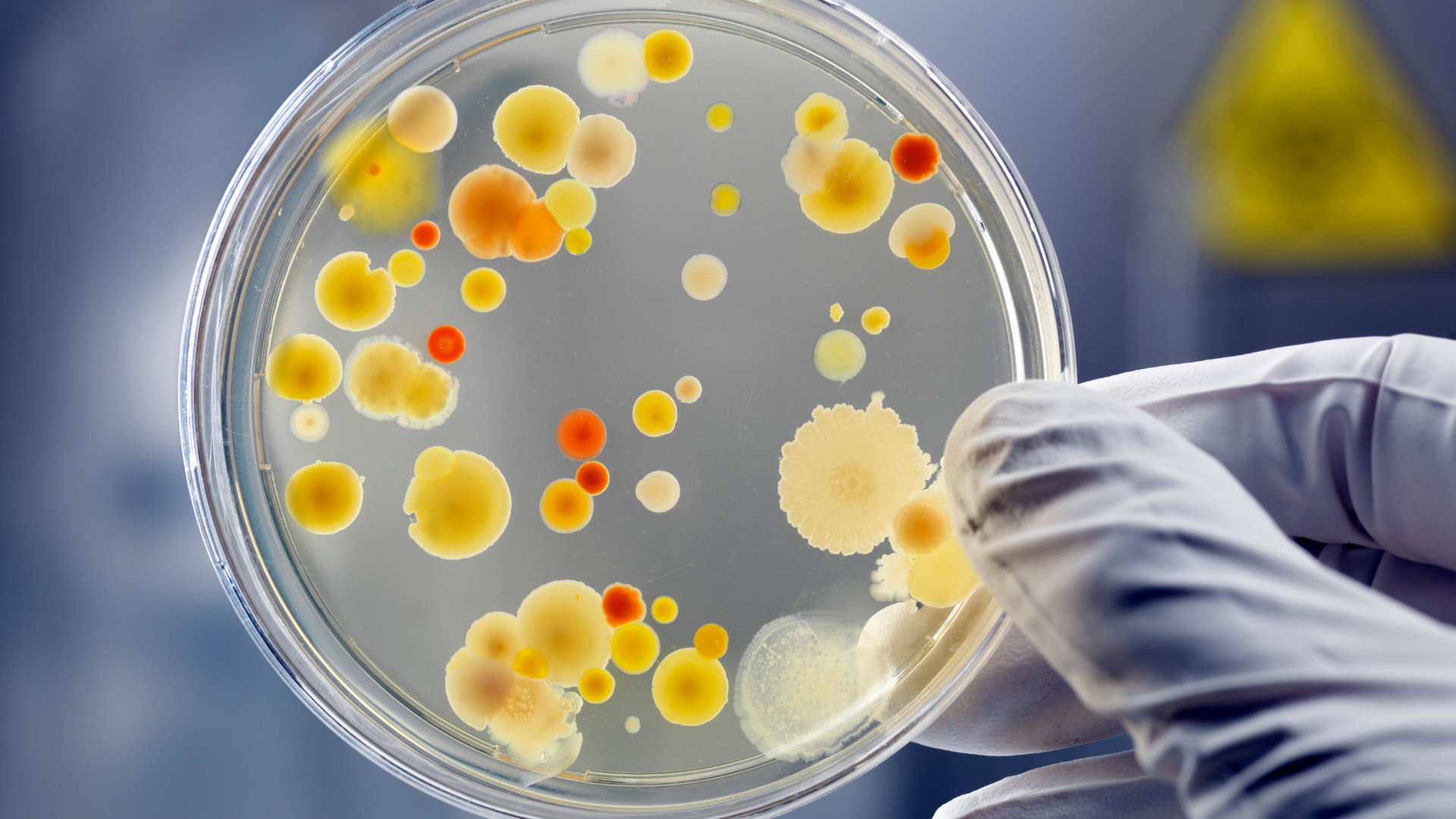 PREVENÇÃO DE INFECÇÃO DE SÍTIO CIRÚRGICO