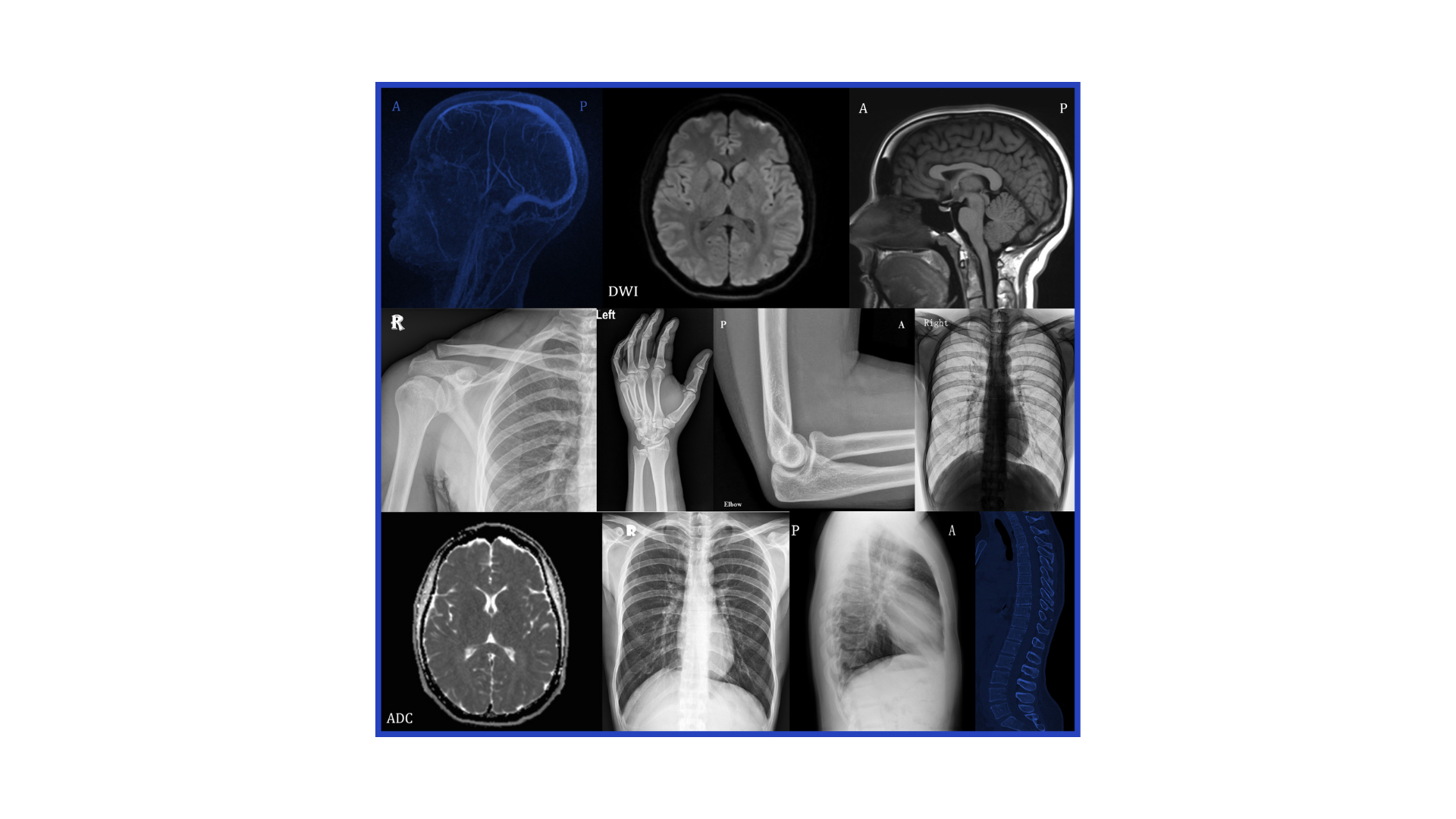VÍDEO - PROTEÇÃO RADIOLÓGICA 2026